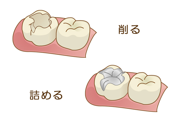 エール歯科クリニックの予防歯科