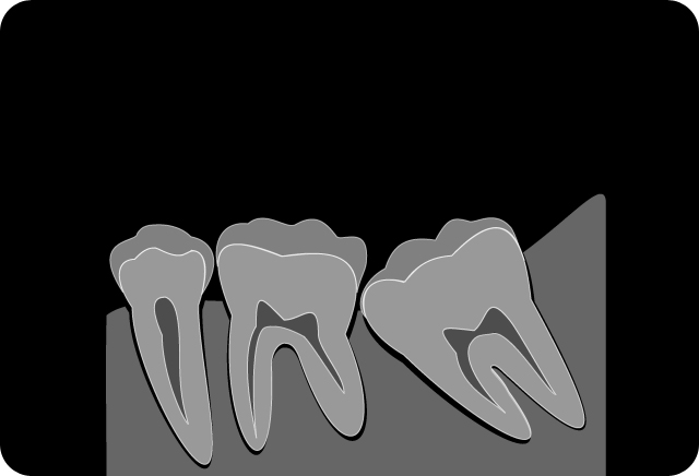 エール歯科クリニックの歯科口腔外科